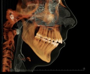 a graphic of Lateral Ceph ICR