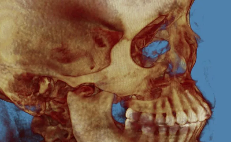 Close-up 3D skull rendering highlighting eye sockets with blue accents and upper teeth