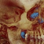 Close-up 3D skull rendering highlighting eye sockets with blue accents and upper teeth