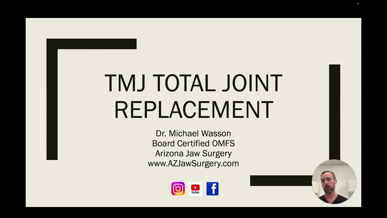 tmj total joint replacement thumbnail