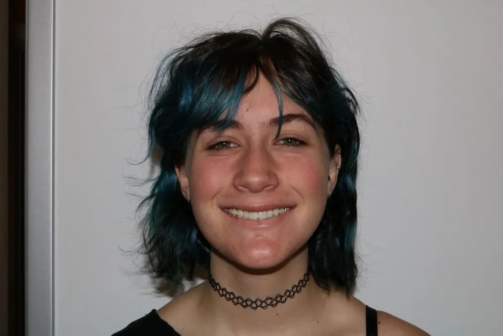 headshot of patient after surgery