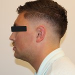 Profile view: male patient with short hair, eyes obscured