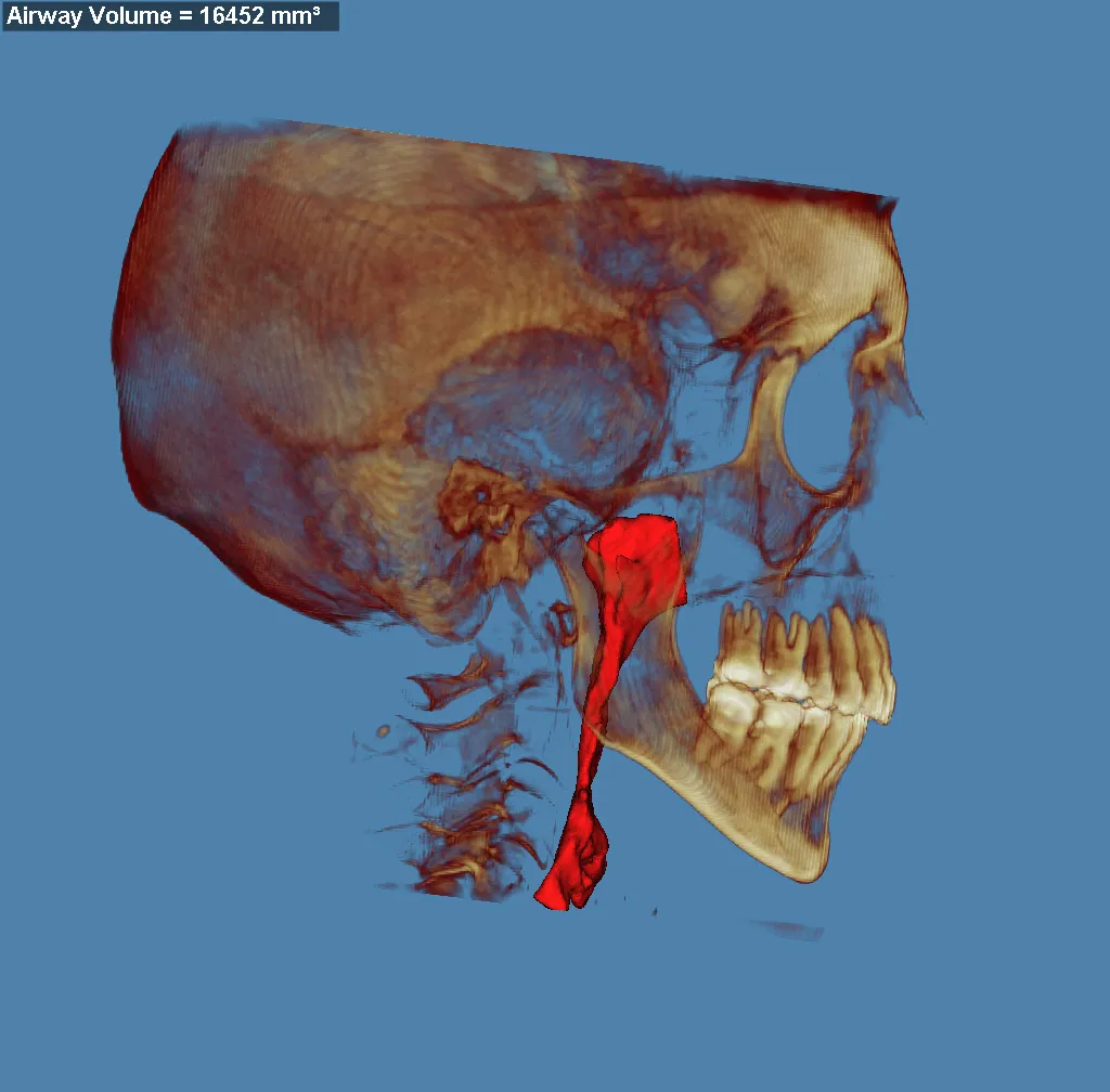 3D skull model with jaw highlighted in red/purple, blue background