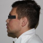 Profile view: male patient with neutral expression, eyes obscured