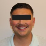 Frontal view: male patient with neutral expression, eyes obscured
