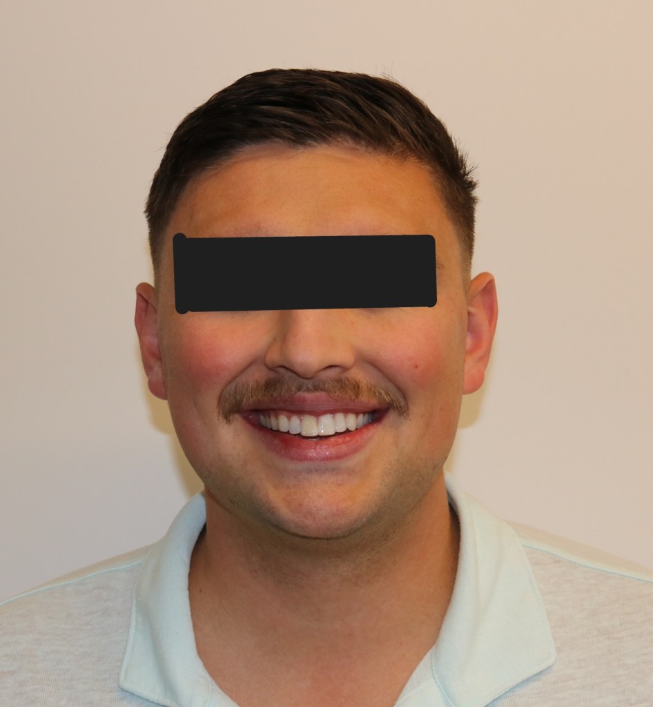 Frontal view: male patient with neutral expression, eyes obscured