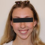 Frontal view: female patient with brown hair tied up, smiling, black top, eyes obscured