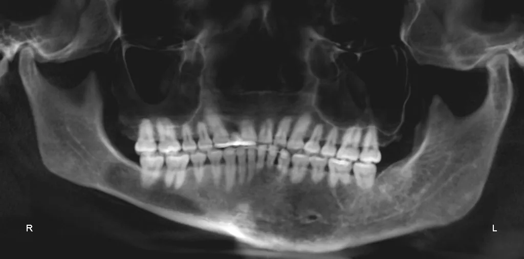 Mp Esthetic Surgery Before/After 2