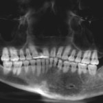 Mp Esthetic Surgery Before/After 2