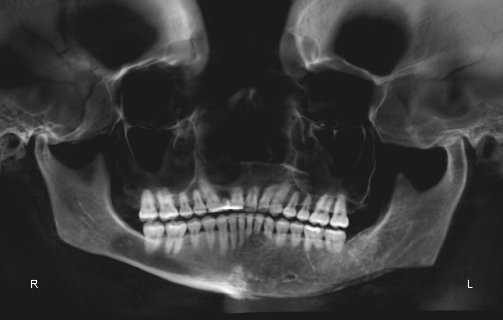 Mp Esthetic Surgery Before/After