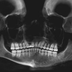 Mp Esthetic Surgery Before/After