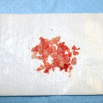 Small pile of red and pink tissue fragments on white surgical drape